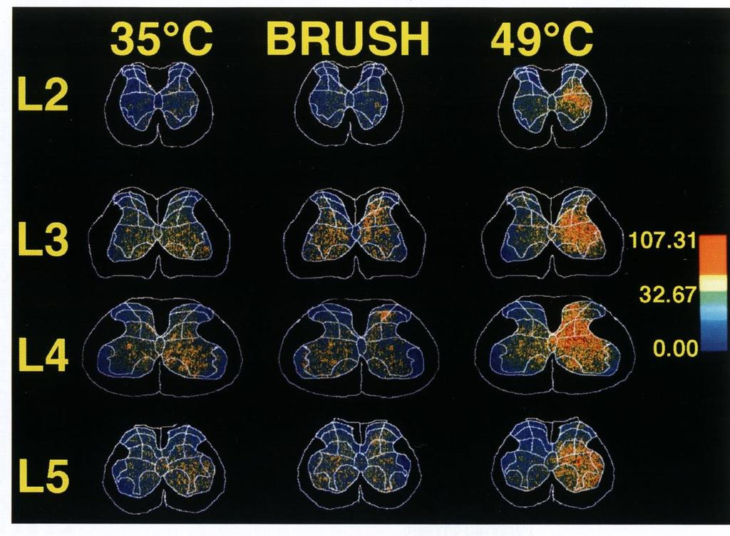 Mapeamento da atividade neuronal na medula com 2-DG (2- desoxiglicose) durante estimulação inócua e nociva.