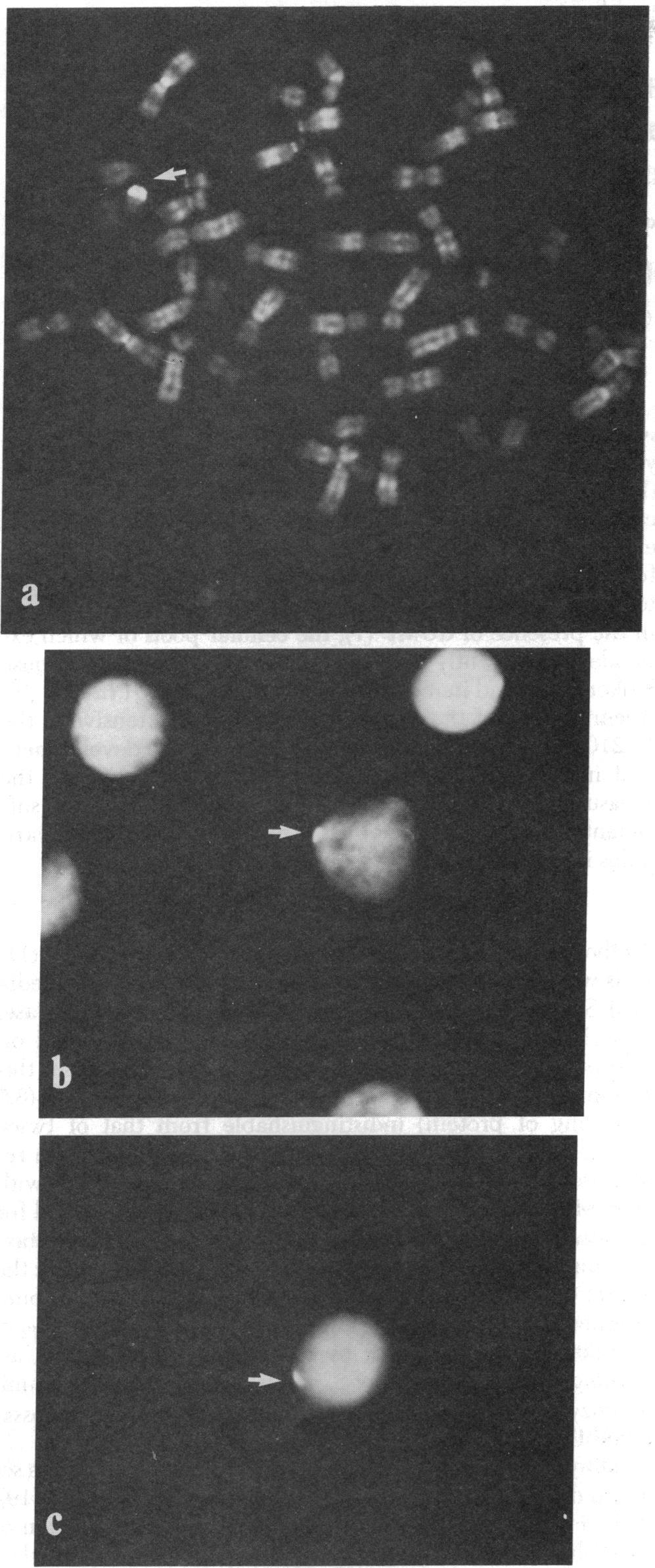 3.3 Contexto Histórico Em 1969, foi reportado (Walknowska et al.) 3, pela primeira vez, a capacidade de recuperar e identificar células fetais provenientes do sangue materno.