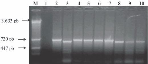 Identificação e diferenciação de herpesvírus bovino tipos 1 e 5 isolados de amostras clínicas 405 localizadas na região codificante do gene da glicoproteína C (gc).
