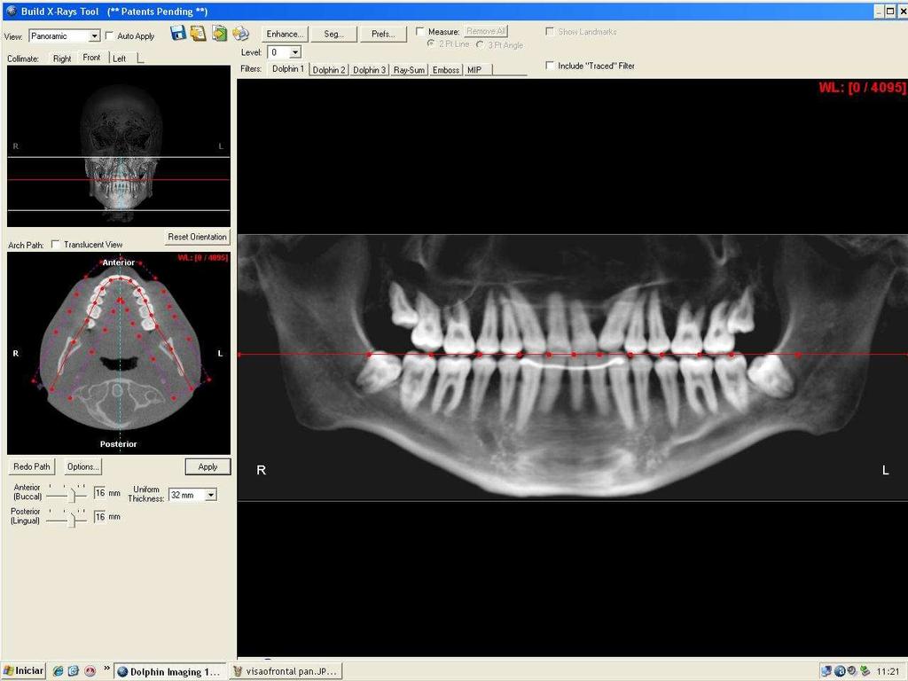 Material e Métodos 81 pela oclusal de todos os dentes, descrevendo novamente uma trajetória parabólica semelhante ao formato da arcada dentária.