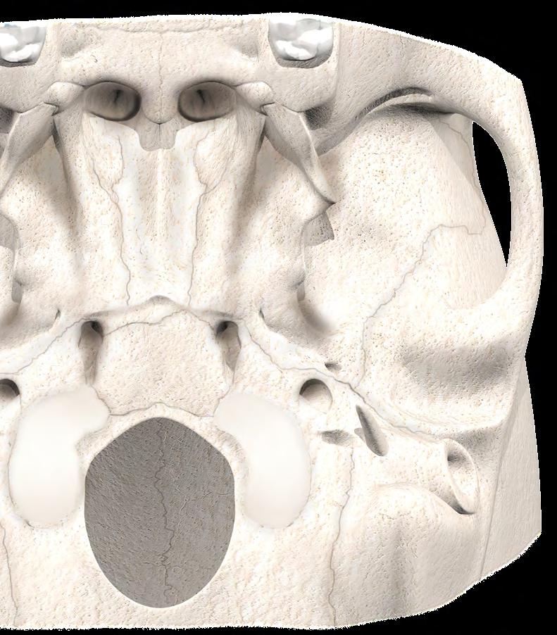 01 CAP 26 27 1 2 3 4 1 - TUBÉRCULO ARTICULAR 2 - FISSURA