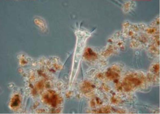 Ao final do experimento foi feita uma lamina do lodo do bioreator, neste ensaio de microscopia foi encontrado diversos tipos de protozoários, na figura 4 observa-se as espécies de Rotífero e