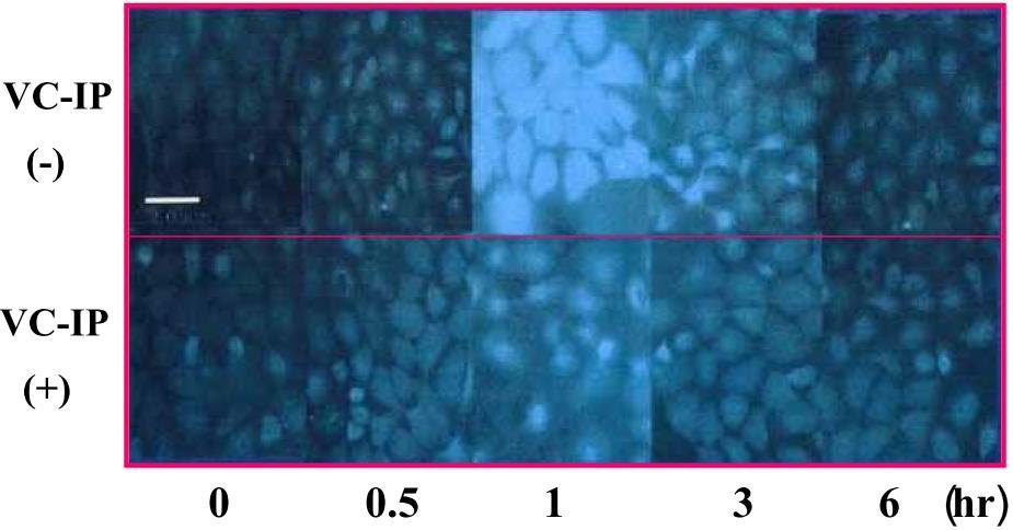 Fotomicrografia do efeito protetor de Nikkol VC-IP em moléculas de DNA expostas à radiação UVA.
