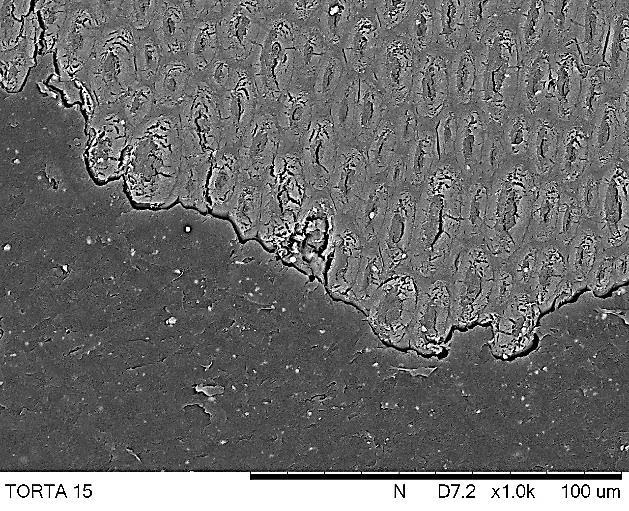 VARREDURA (MEV) Microscopia