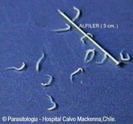 Verminoses causadas por Nematelmintos Oxiuríase - Agente etiológico: Enterobius vermiculares; - Hospedeiros: apenas humanos; - Local do parasitismo: intestino grosso.