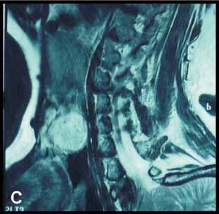 REPORT FIGURA 3 Endoscopia contacto: