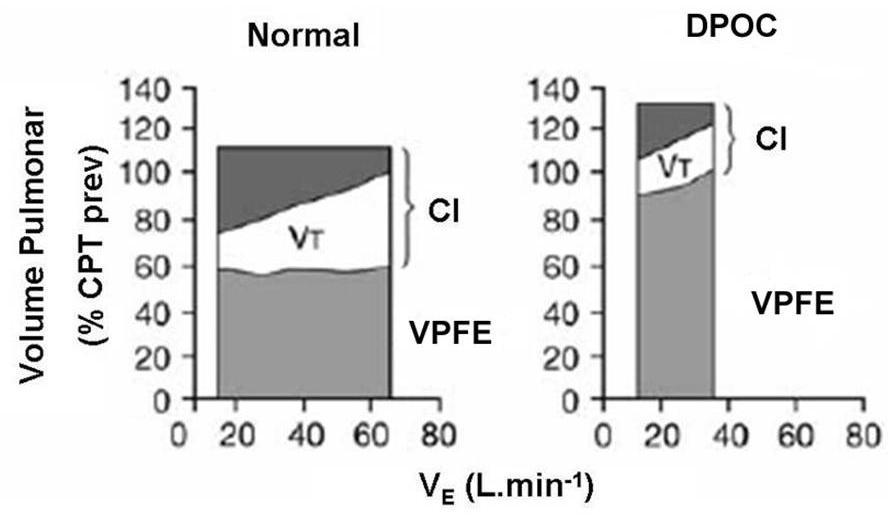 Figura 3: Diferenças no comportamento do VPFE num indivíduo saudável e em paciente com DPOC durante o esforço.