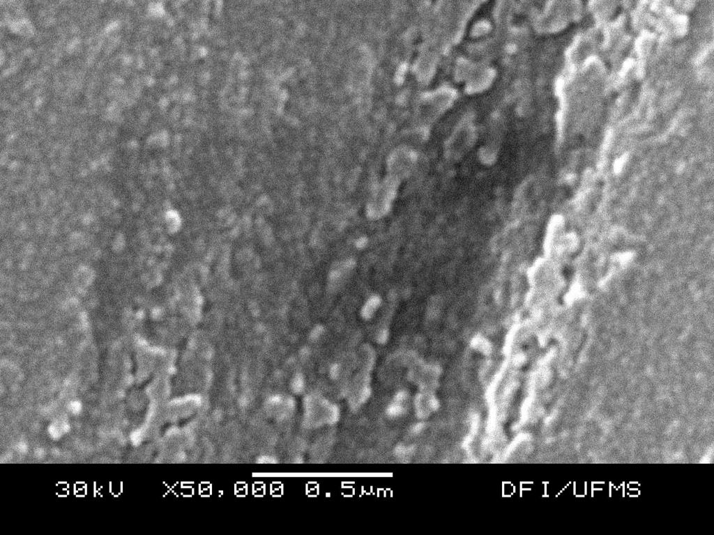 Figura 2 : Imagens de MEV da superfície do eletrodo