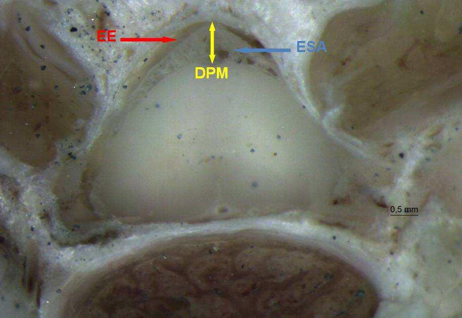 Resultados e Discussão 41 Figura 9 - Corte transversal da oitava vértebra pré-sacral, evidenciando os espaços epidural
