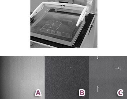 Unidade VII Controle de Qualidade em Mamografia Aula 2 ser examinadas na estação de trabalho, com a largura e o nível de janela recomendados pelo físico-médico.
