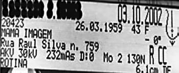 Unidade V Técnica de Realização da Mamografia Aula 1 Na mamografia convencional (Figura 37), os marcadores radiopacos de identificação (numeradores) por convenção devem ser colocados em