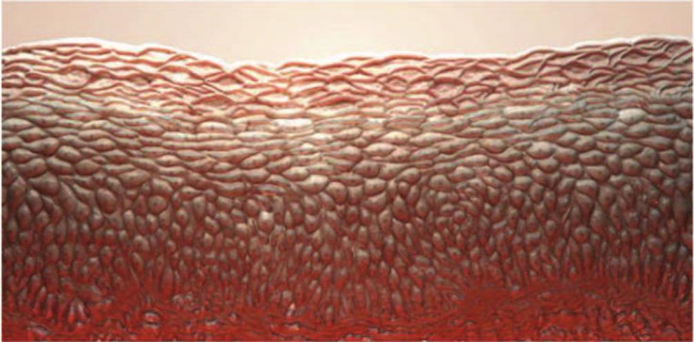 As células superficiais são achatadas como se fossem escamas e possuem queratina.