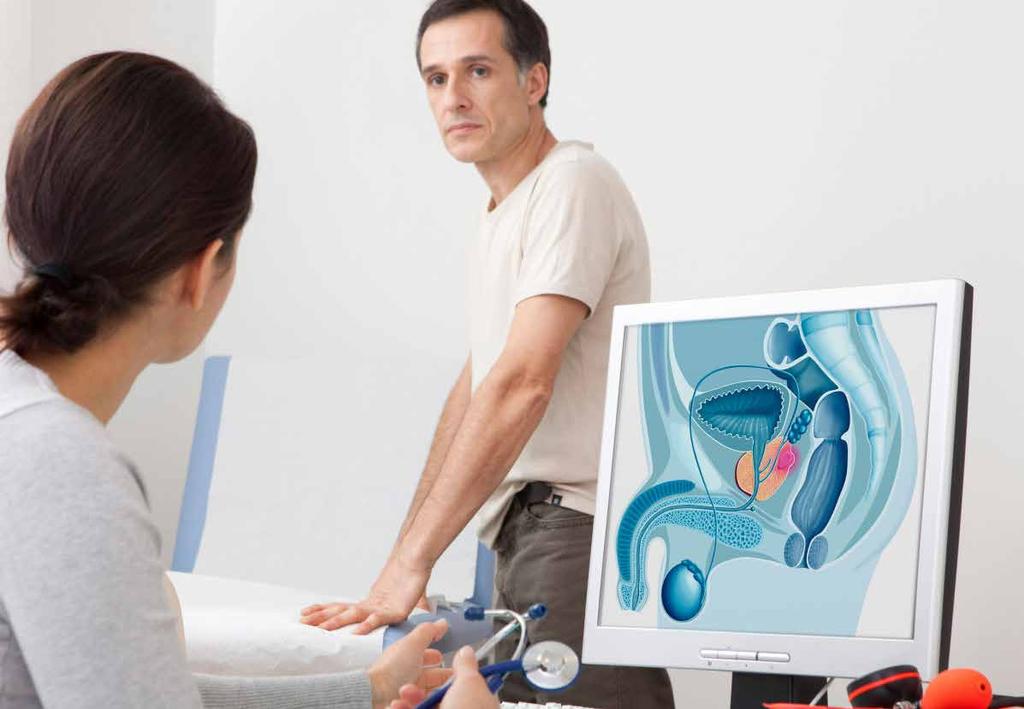 CÂNCER DE PRÓSTATA O TRATAMENTO O tratamento padrão para o câncer de próstata é a prostatectomia radical, que consiste na retirada da próstata, das vesículas seminais e linfadenectomía