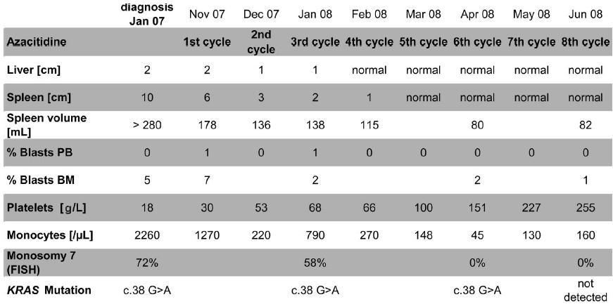 Metilação do DNA em SMD pediátrica Paciente com LMMJ e monossomia 7 (1,5 anos) - tratamento com
