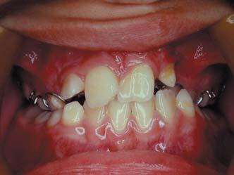 Pediatric Dentistry and