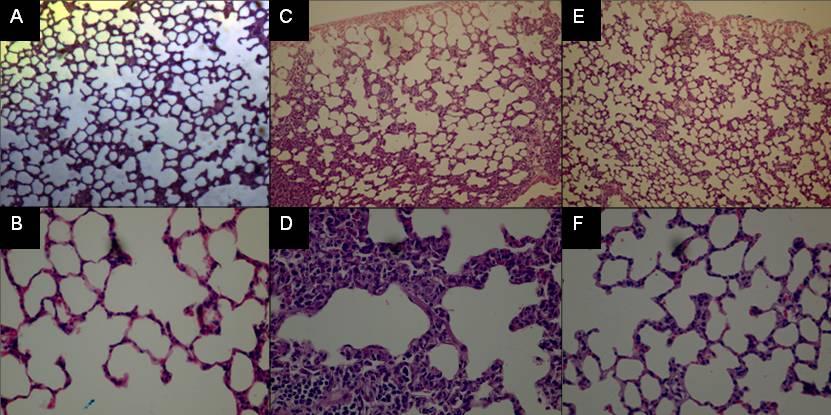 83 Figure 4 Lung histology Figure 4: Right lung inferior lobe longitudinal sections from: (A) control, (C) supine, and (E) prone groups (H&E, 100 ); (B) control, (D)
