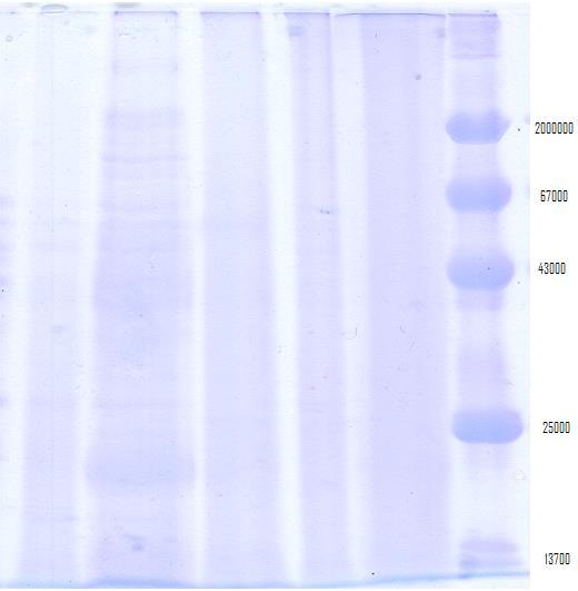 A P3 (soro) P2 (soro) P1(soro) Soro C M Figura 5.1 Análise por electroforese SDS-PAGE, gel a 12,5%, da amostra extraída pelo método de Durauer e por precipitações do soro C.