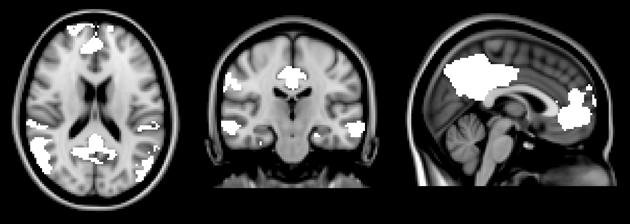análise de dados. A partir desses dados foi criada a máscara que contém as áreas cerebrais mais consistentes que definem a DMN.