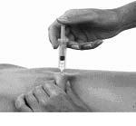 Administre o conteúdo da seringa, pressionando para baixo êmbolo até ao fim. 8. Retire a seringa da pele (fig. 4). O local da injecção não deve ser friccionado. 9.