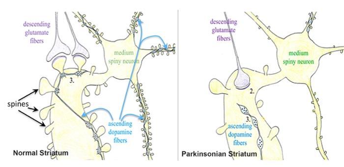 Mal de Parkinson Images modified from Steece-Collier et al.