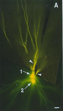 Destino dos axônios que chegam no corpo estriado A B A é um neurônio espinhoso