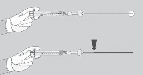 Gomes M, Romcy H BD PosiFlush com solução salina de 10 ml convencional de 10 ml Sem refluxo Média de refluxo constatada em um PICC 18 G (4 Fr) x 65 cm. Arquivos com dados na BD. Figura 2.