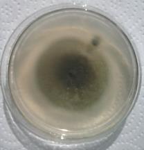 RESULTADOS E DISCUSSÃO A partir e amostras da secreção cérea, foram isolados dois fungos que estão em processo de identificação, portanto nesse resumo serão referenciados como fungo 1 e 2 (Figura 1).