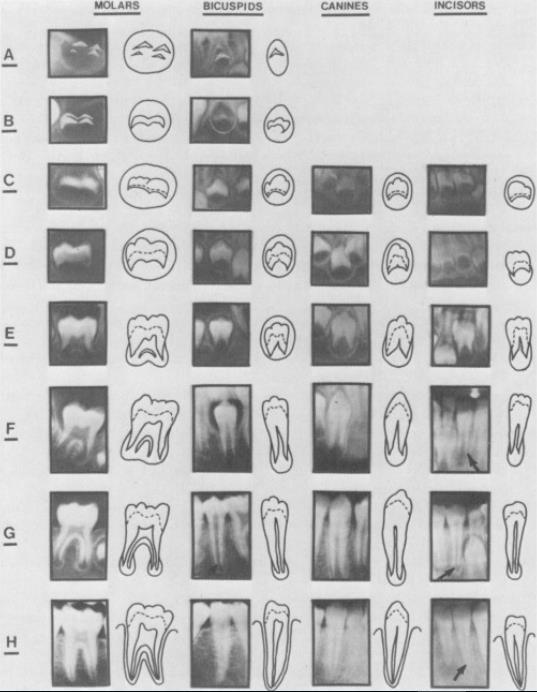 33 dentes inferiores do lado esquerdo. Os autores utilizaram radiografias panorâmicas de 1446 meninos e 1482 meninas de ascendência canadense francesa.