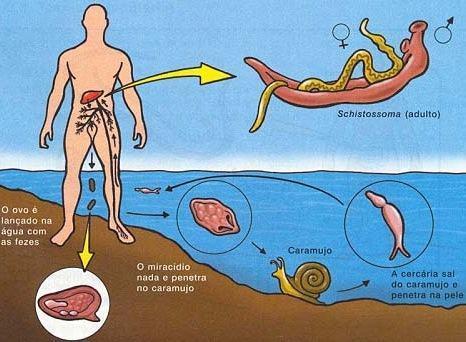 ESQUISTOSSOMOSE AMERICANA barriga d água ou xistose Agente