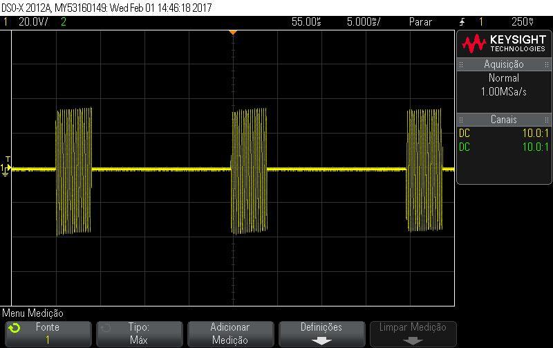 CORRENTE AUSSIE DRENAGEM LINFÁTICA, ANALGESIA E ELETROLIPÓLISE Frequência portadora: 4 khz Duração dos Bursts: 4ms Frequência