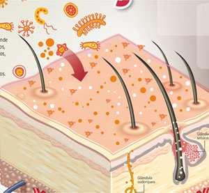 A microbiota transitória Microrganismos como bactérias, fungos e vírus, que raramente se multiplicam na pele. No entanto, alguns podem provocar infecções relacionadas a assistência a saúde.
