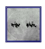 METÁFASE II Alinhamento dos cromossomos na placa