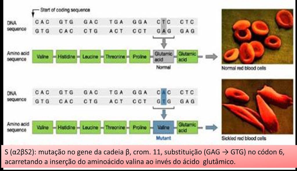 24 2.2 Hemoglobina S A mutação pontual no gene β globina, com a troca de uma adenina por uma timina (GAG GTG), resulta na substituição de ácido glutâmico por valina na posição seis da cadeia beta
