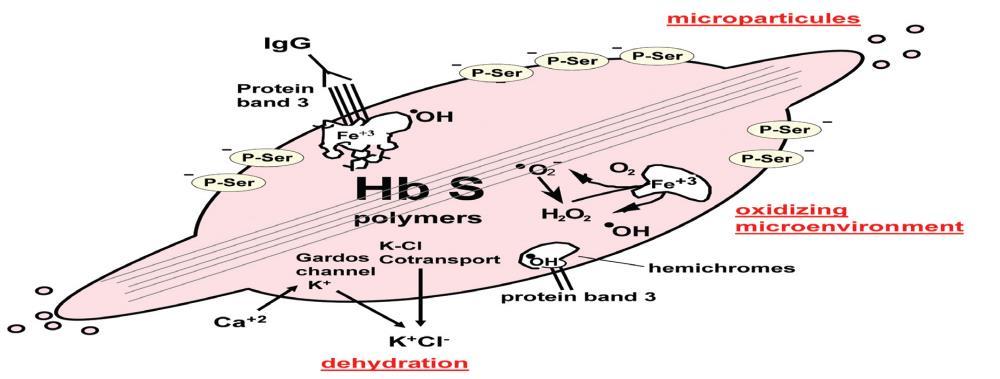 25 Figura 6 - GLU VAL na posição 6 da cadeia β caracteriza a Hb anormal: HbS.