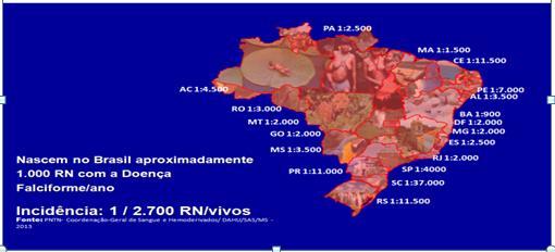 28 Figura 9 - Incidência da doença falciforme no Brasil. Fonte: Portal da Saúde. Ministério da Saúde. Brasil, 20