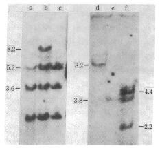 O Experimento de Pierre Chambon (1981) com cdna de ovoalbumina 1872 pb: Southern Blot do DNA