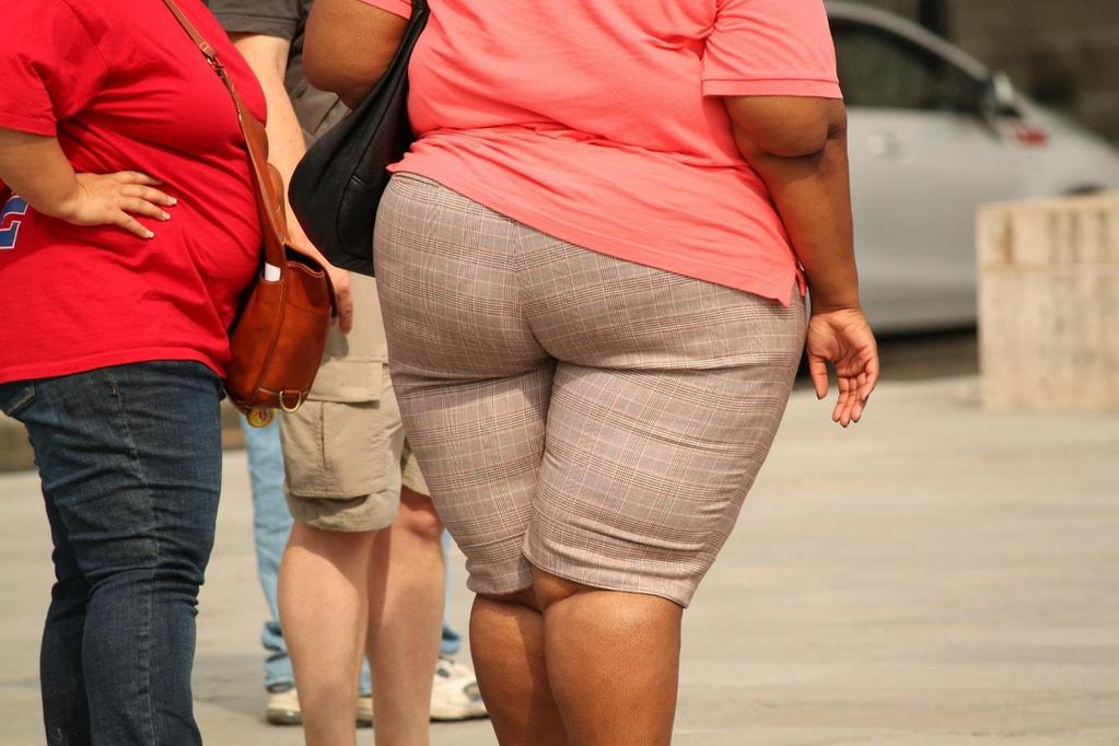 INTRODUÇÃO A obesidade é uma séria questão médica e social que afeta milhões de pessoas.