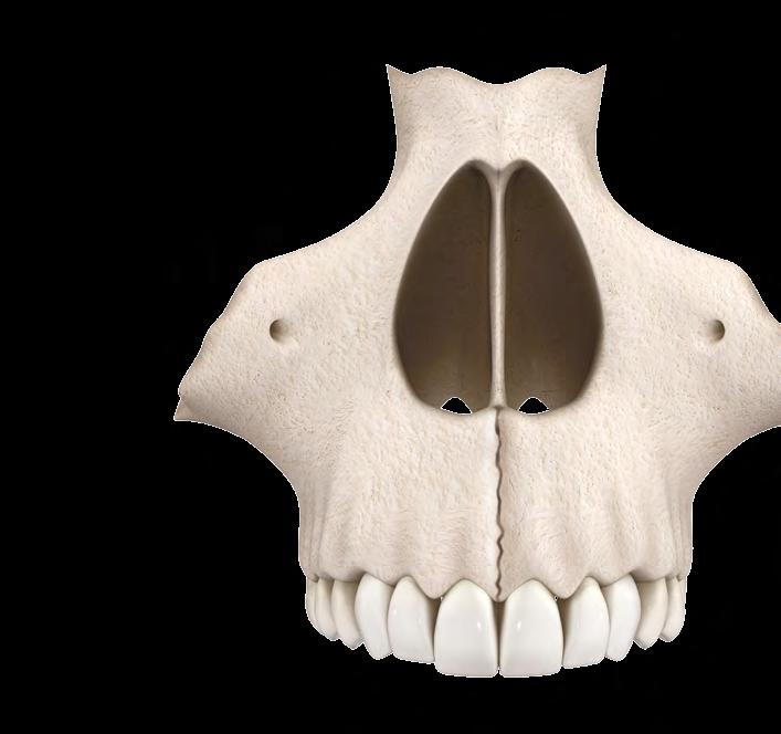 A ARTE NA PRÓTESE DENTÁRIA ANATOMIA A maxila é um osso par, irregular e pneumático, com forma piramidal, que compõe parte do viscerocrânio e é o mais volumoso de todos os ossos do complexo