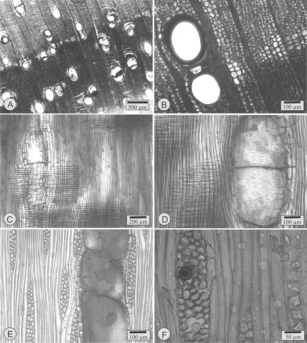 FIGURA 1 - Fotomicrografias da madeira de Melia azedarach.