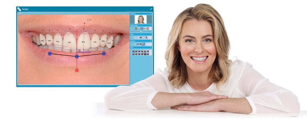 Além de pacientes, o software permite a melhoria da comunicação com especialistas e laboratórios dentários - resultando em uma melhor realização de projetos criados.