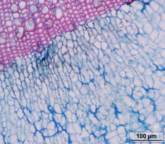 fibroso do cilindro vascular; (F) - Detalhe