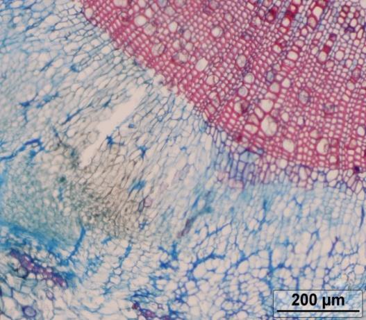 tecido vascular.