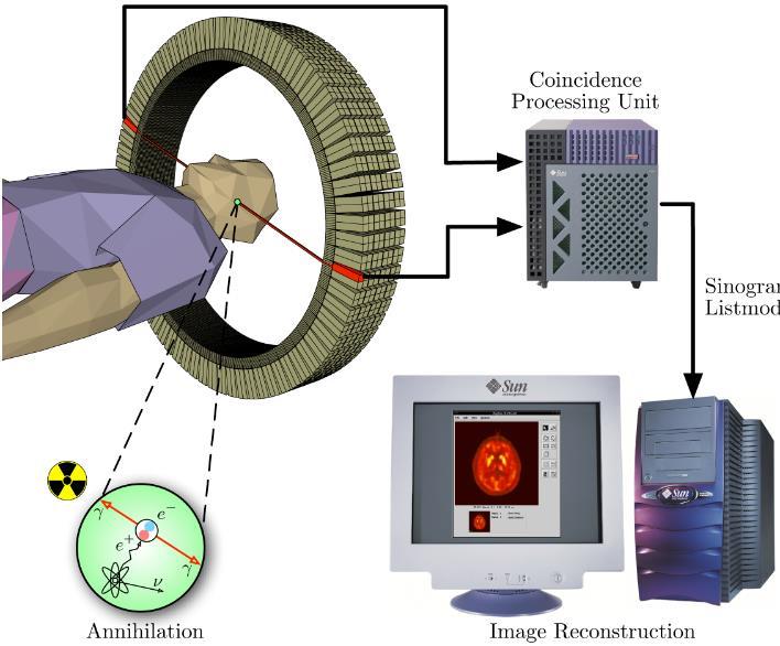 Aplicações da radiação ionizante PET (Positron Emission Tomography) TEP (Tomografia por Emissão de Positrões) 1. Utiliza-se glicose ligada a um elemento radioactivo. Unidade de processamento 2.