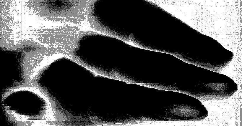 Scannimages 5. Hand, imagem produzida por meio de scanner manual sobre pele.