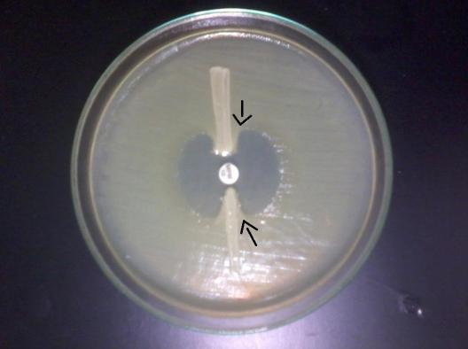 Identificação de KPC: A identificação foi feita pelo Teste de Hodge Modificado (MHT), onde foi inoculada a Escherichia coli ATCC 25922 e colocado um disco de Meropenem no centro da placa.
