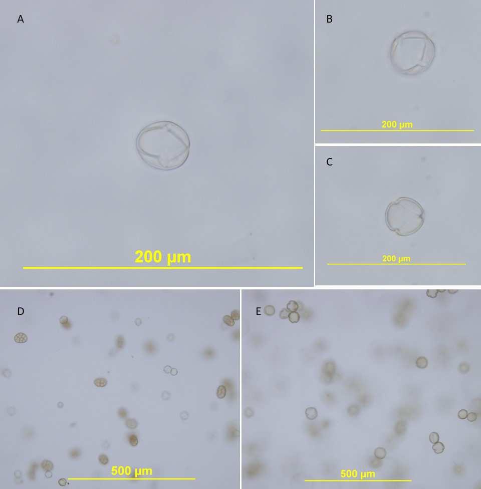 20 FIGURA 7. Imagens de microscopia de grãos de pólen. A, B, visão equatorial do pólen da flor de tomate, C, visão polar. Em objetiva de 40x com aumento.
