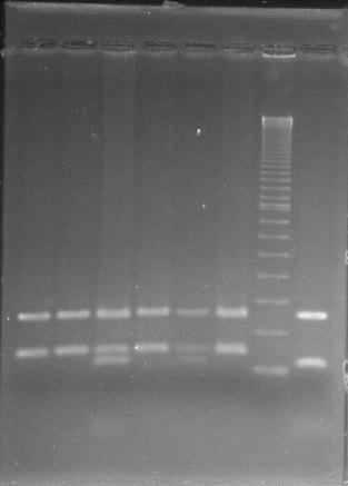 Figura 3. Representação dos tamanhos dos fragmentos obtidos na PCR-RFLP para a detecção da mutação p.c282y no gene HFE.