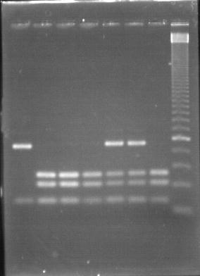 Figura 5. Representação dos tamanhos dos fragmentos obtidos na PCR-RFLP para a detecção da mutação p.h63d no gene HFE.