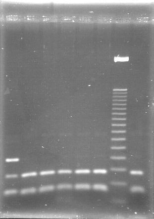 Figura 7. Representação dos tamanhos dos fragmentos obtidos na PCR-RFLP para a detecção da mutação p.s65c no gene HFE.