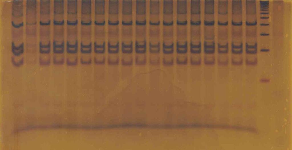 Figura 9. Representação dos tamanhos dos fragmentos obtidos na PCR-RFLP para a detecção da mutação p.q690p no gene TFR2. 203 pb 106 pb 94 pb 70 pb marcador de 50 pb Figura 10.